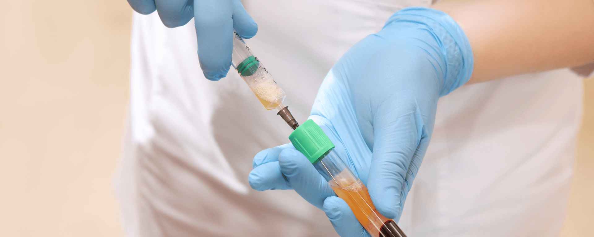 Plasma Services Group